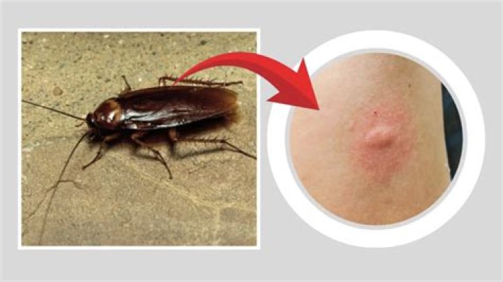 A Cockroach Can Bite With a Force 50 Times Its Body Weight Science